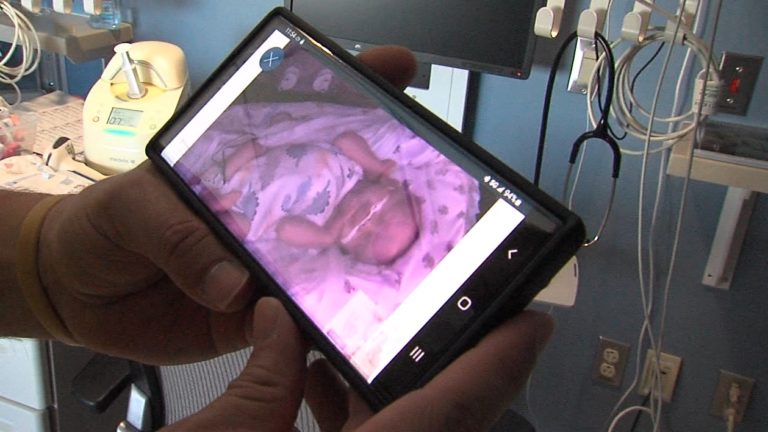 Bedside Cameras Help Moms Pump More