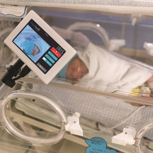 NICU Camera Viewing Baby | AngelEye Health