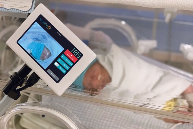 NICU Camera Viewing Baby | AngelEye Health